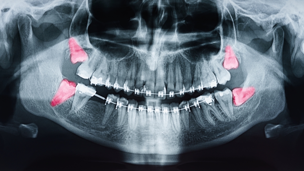 DIAGNOSTYKA STOMATOLOGICZNA