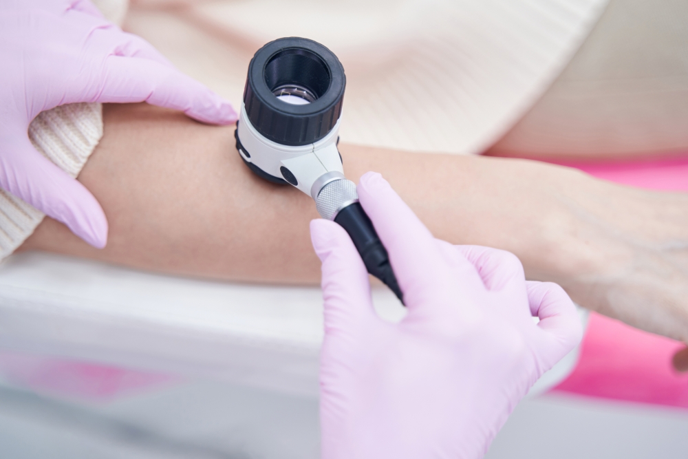 DERMATOSKOPIA ( DIAGNOSTYKA ZMIAN SKÓRNYCH)